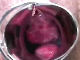 Беременная телка пришла в больницу